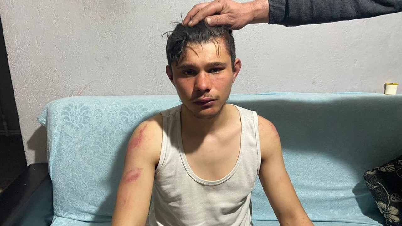 Turkish teenager battered by employers for seeking his unpaid wages