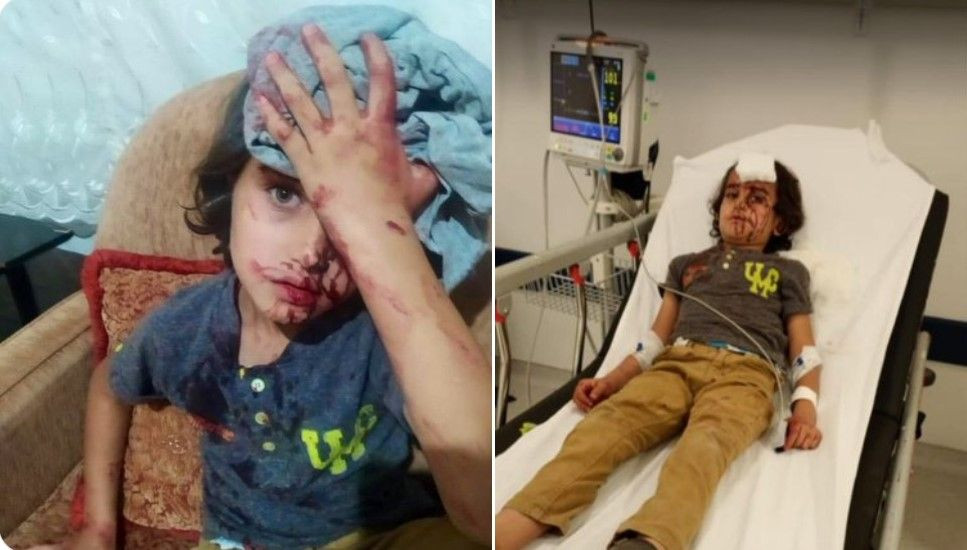 Child wounded in mob attack on Syrians in Turkey's Ankara - Page 1