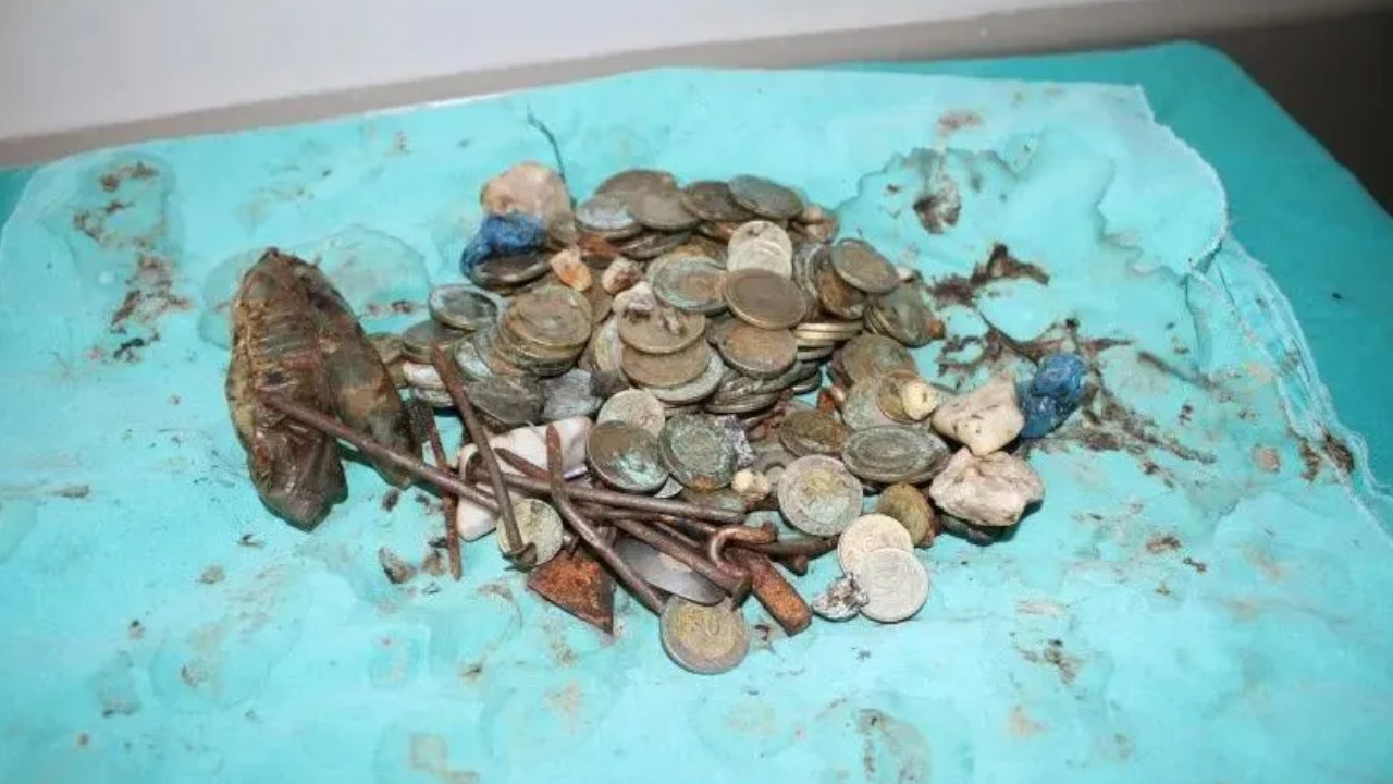 Turkish doctors find 83 coins in man's stomach