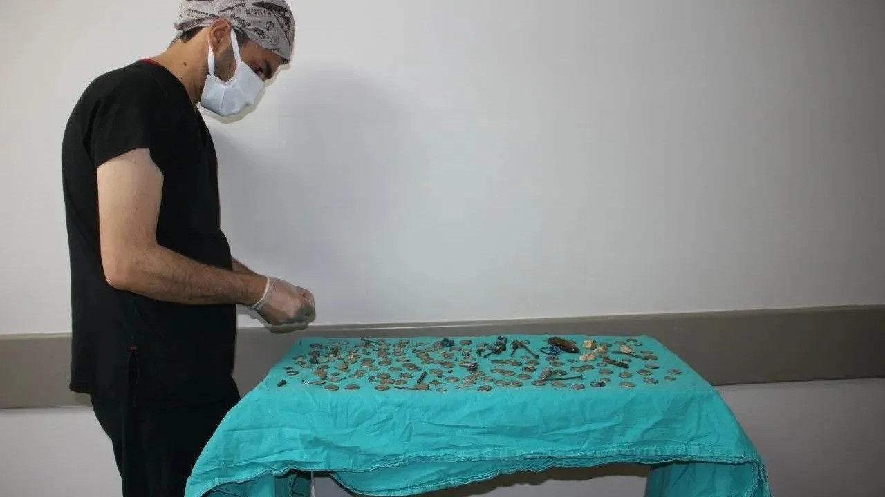 Turkish doctors find 83 coins in man's stomach