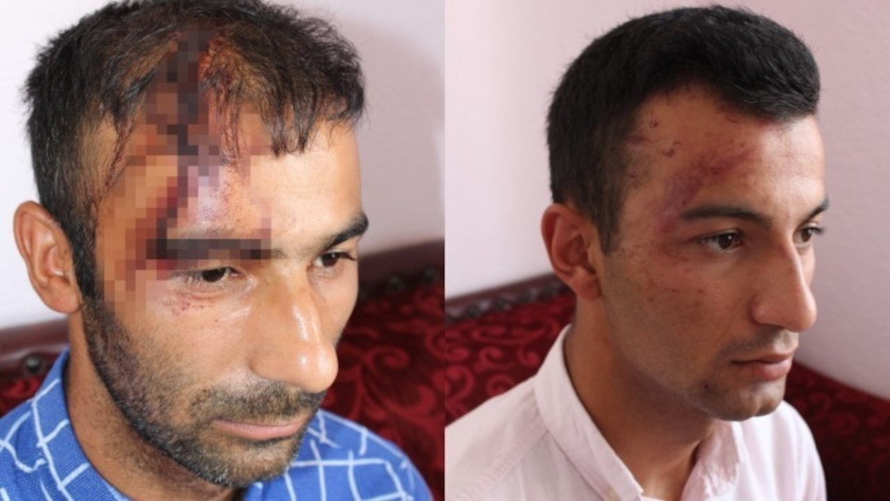 Kurdish family battered in racist attack in western Turkey