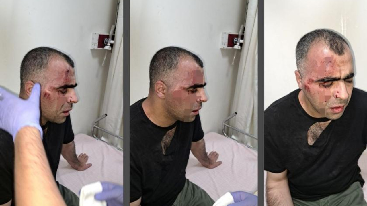 Turkish journalist Sinan Aygül attacked by Tatvan Mayor's guards over corruption reporting