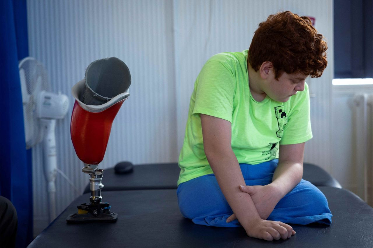 Turkey's quake survivor boy relearns walking with prosthetic legs - Page 1