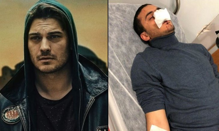 Egyptian actor mistaken for Syrian refugee gets violently beaten in Istanbul