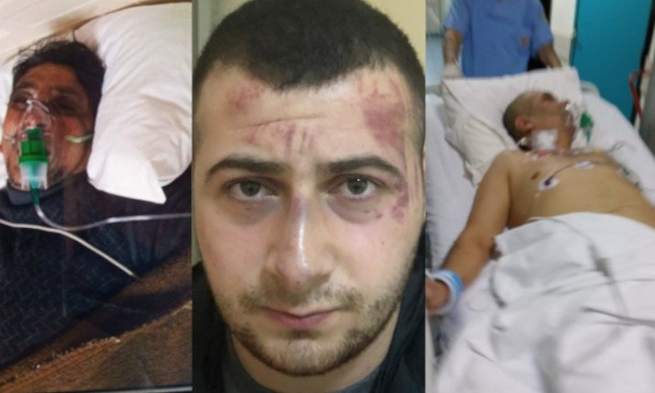 Police beat Kurdish family at Istanbul hospital