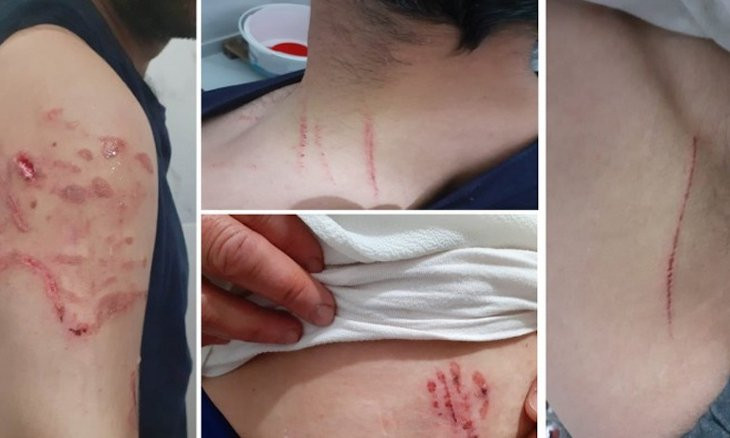 Police make dogs attack couple when raiding their house in southeastern Turkey