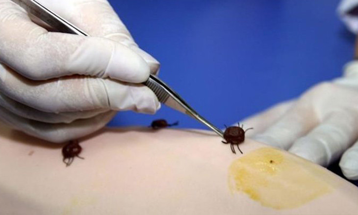Turkey observes increase in numbers of viral disease transmitted through ticks