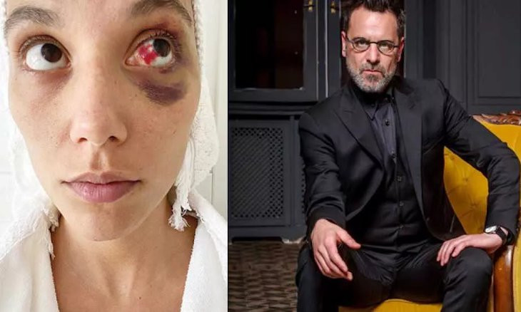 Over 100 scriptwriters urge joint stance against Ozan Güven after Turkish actor beats girlfriend