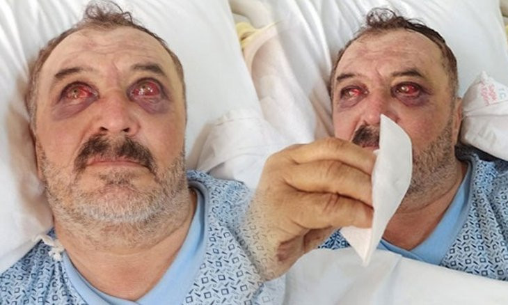 Man thrown off helicopter in southeast Turkey reveals scope of state violence